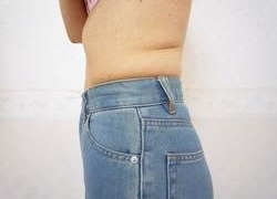 50代女性ウエスト 施術後