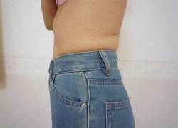 50代女性ウエスト 施術後