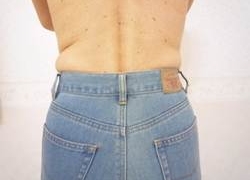 50代女性ウエスト 施術後