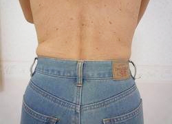 50代女性ウエスト 施術後