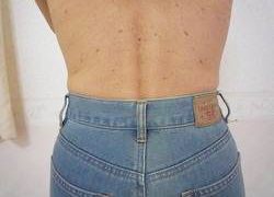 50代女性ウエスト 施術後